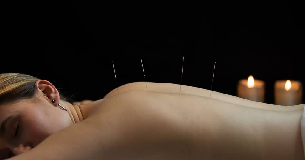 what_is_acupuncture