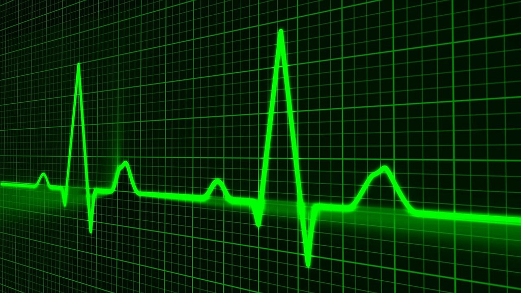 pulse trace, healthcare medicine, heartbeat-163708.jpg