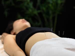 Acupuncture_at_huatuo_clinic