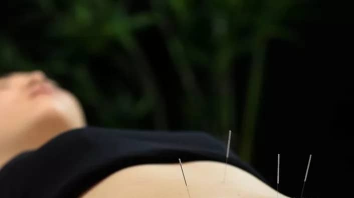acupuncture for dysmenorrhea